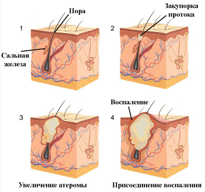 Причинами возникновения